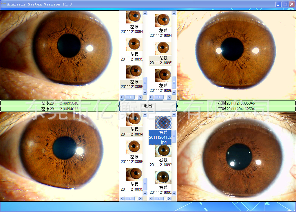 厂家供应电脑型usb左/右灯虹膜检测仪,虹膜仪,3d自动分析虹膜仪