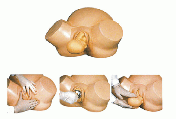 【康谊牌KAY-8 高级助产训练模型、胎位分娩