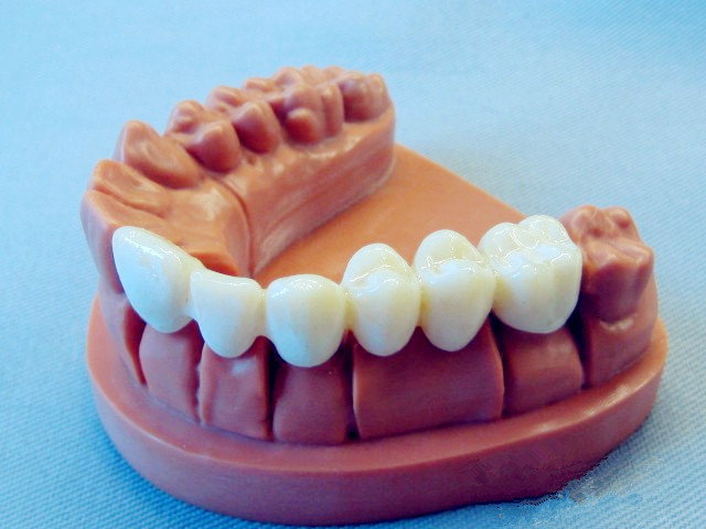 字牙科三维扫描仪厂家直销 牙桥牙齿模型3D打