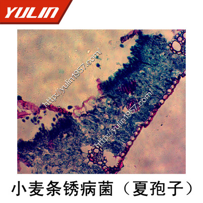 植物病理学麦类病害植物小麦条锈病菌(夏孢子)显微镜标本切片